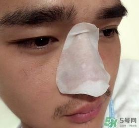 wis去黑头套装多少钱?wis去黑头套装价格