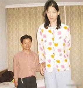 ​世界第一女巨人身高2.36米，穿78码鞋子，一生凄惨死因令人