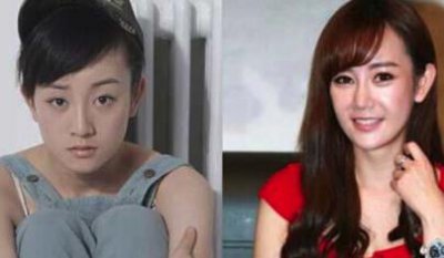 ​张檬为什么要整容 张檬整容前后照片对比