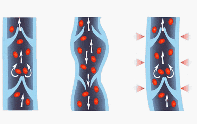 周冬雨多高多重(162cm周冬雨)