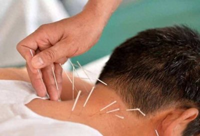 ​什么是“金钩钓鱼”针法，对治疗慢性萎缩性胃炎有什么作用？