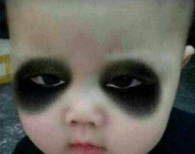 熬夜黑眼圈怎么去除 既简单又容易(黑眼圈怎么去除最有效的方法有哪些)