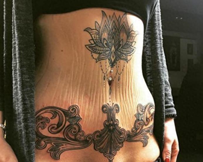 产后妈妈晒肚子上的妊娠纹，赘皮触目惊心，网友却说这很美