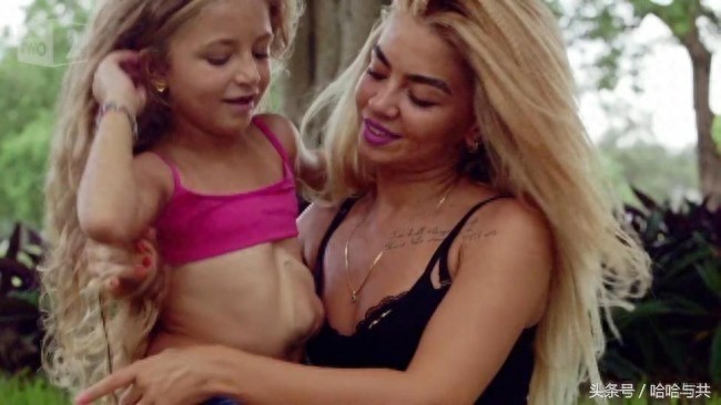 俄罗斯7岁女孩天生心脏长在外面,乐观开朗的她迅速走红网络