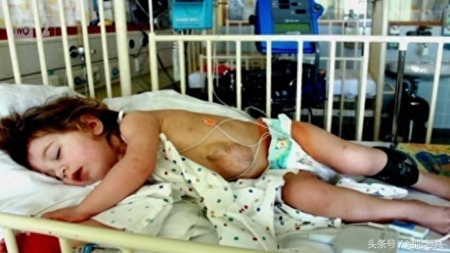 俄罗斯7岁女孩天生心脏长在外面,乐观开朗的她迅速走红网络