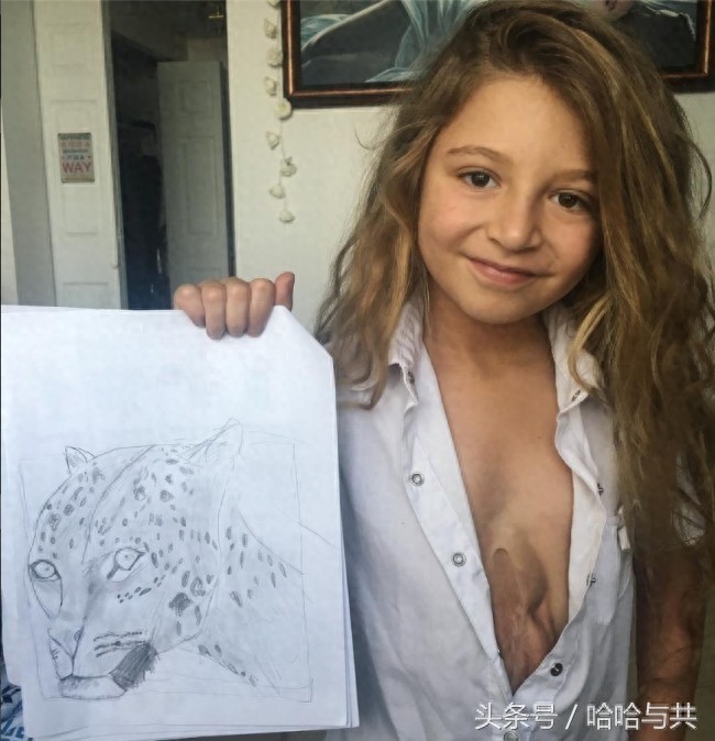 俄罗斯7岁女孩天生心脏长在外面,乐观开朗的她迅速走红网络